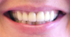 cyndi after
